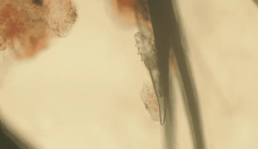 Demodex mite seen under microscope